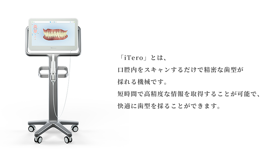 口腔内3Dスキャナー「iTero」とは？｜江戸川区の矯正歯科専門医院「アルファー歯科」